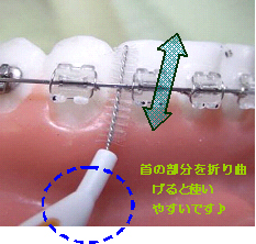 歯間ブラシブレイク３１.JPG